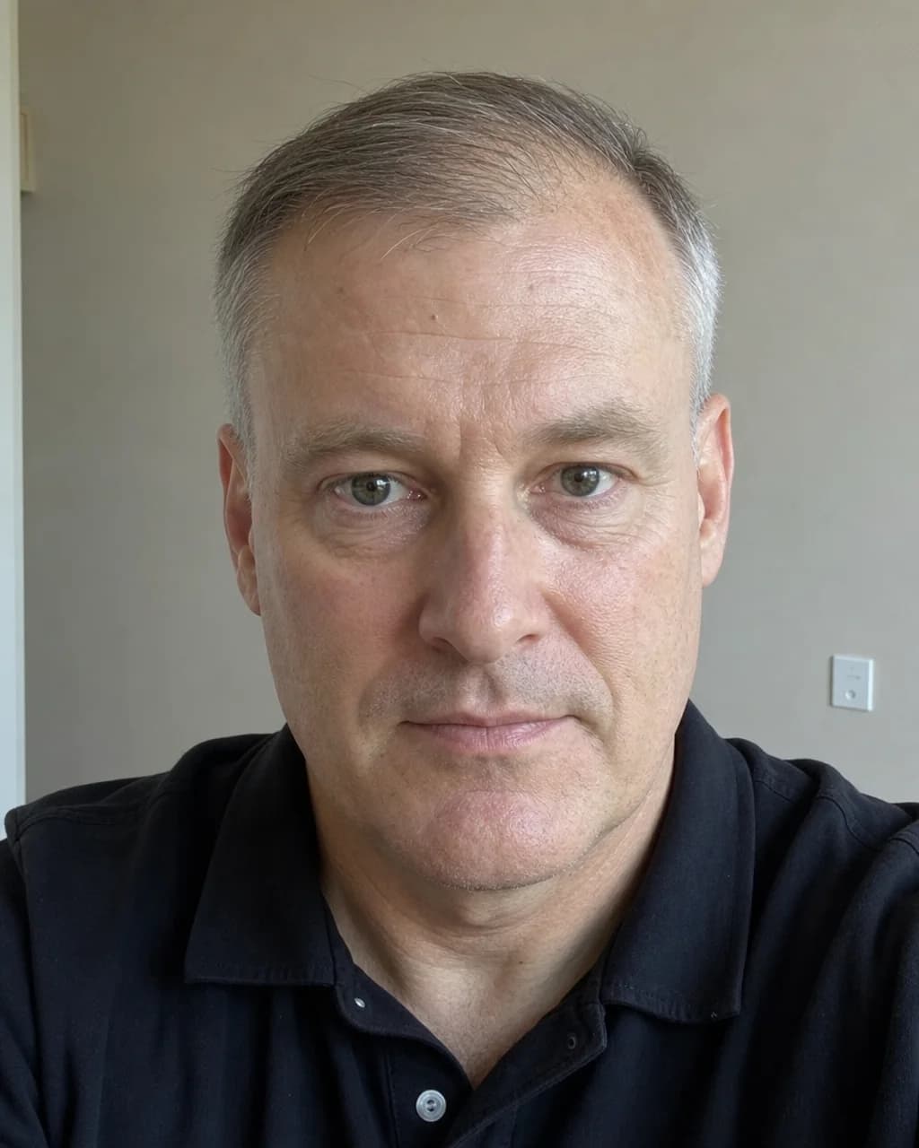 Fictional man with fine, thinning hair and receding temples